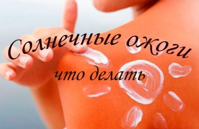 Такое «фото» нам не нужно или памятка на случай солнечного ожога